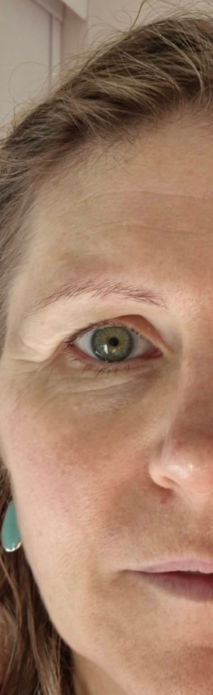 Half-face photograph on Day 1